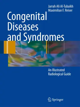 Al-Tubaikh / Reiser |  Congenital Diseases and Syndromes | Buch |  Sack Fachmedien