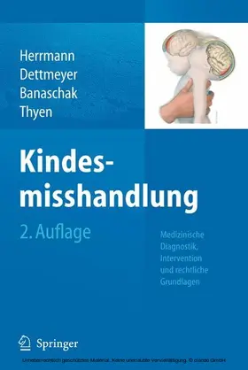 Herrmann / Banaschak / Thyen |  Kindesmisshandlung | eBook | Sack Fachmedien