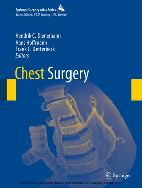 Dienemann / Hoffmann / Detterbeck |  Chest Surgery | eBook | Sack Fachmedien