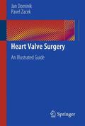 Dominik / Zacek |  Dominik, J: Heart Valve Surgery | Buch |  Sack Fachmedien