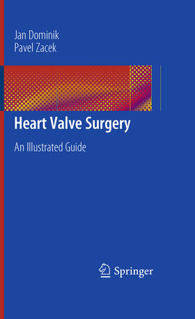 Dominik / Zacek | Heart Valve Surgery | E-Book | sack.de