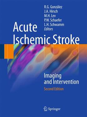 González / Hirsch / Lev | Acute Ischemic Stroke | Buch | 978-3-642-12750-2 | sack.de