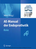 Wirtz |  AE-Manual der Endoprothetik | eBook | Sack Fachmedien