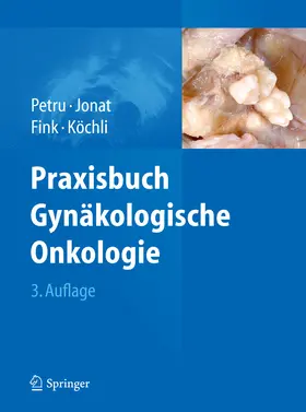 Petru / Jonat / Fink |  Praxisbuch Gynäkologische Onkologie | eBook | Sack Fachmedien