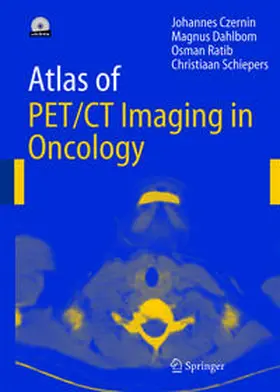 Czernin / Dahlbom / Ratib |  Atlas of PET/CT Imaging in Oncology | eBook | Sack Fachmedien