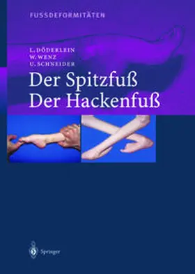 Döderlein / Wenz / Schneider |  Fussdeformitäten | eBook | Sack Fachmedien
