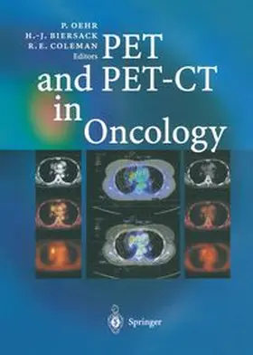 Oehr / Biersack / Coleman |  PET and PET-CT in Oncology | eBook | Sack Fachmedien