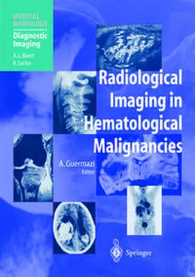 Guermazi |  Radiological Imaging in Hematological Malignancies | eBook | Sack Fachmedien