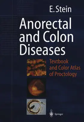 Stein |  Anorectal and Colon Diseases | eBook | Sack Fachmedien