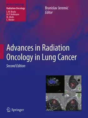 Jeremic |  Advances in Radiation Oncology in Lung Cancer | eBook | Sack Fachmedien