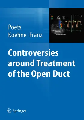 Poets / Koehne / Franz |  Controversies around treatment of the open duct | Buch |  Sack Fachmedien