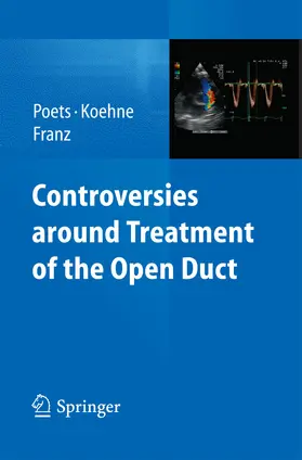 Poets / Koehne / Franz |  Controversies around treatment of the open duct | eBook | Sack Fachmedien