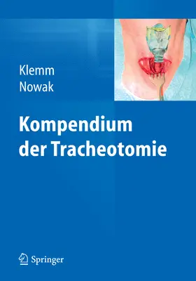 Klemm / Nowak |  Kompendium der Tracheotomie | eBook | Sack Fachmedien