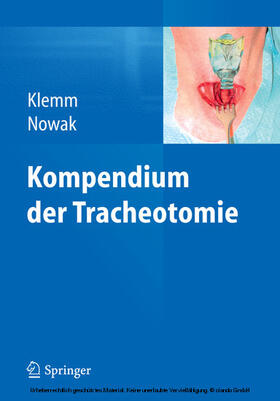 Klemm / Nowak | Kompendium der Tracheotomie | E-Book | sack.de