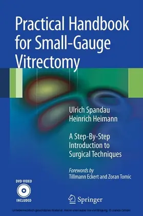 Spandau / Heimann |  Practical Handbook for Small-Gauge Vitrectomy | eBook | Sack Fachmedien