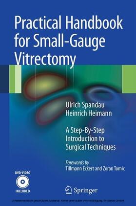 Spandau / Heimann | Practical Handbook for Small-Gauge Vitrectomy | E-Book | sack.de