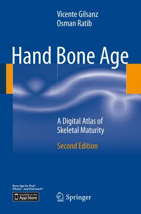 Gilsanz / Ratib |  Hand Bone Age | eBook | Sack Fachmedien