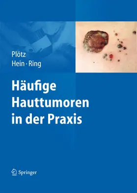 Plötz / Hein / Ring |  Häufige Hauttumoren in der Praxis | eBook | Sack Fachmedien