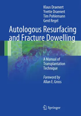 Draenert / Pohlemann / Regel |  Autologous Resurfacing and Fracture Dowelling | Buch |  Sack Fachmedien