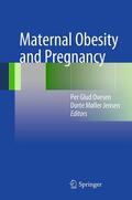 Ovesen / Møller Jensen |  Maternal Obesity and Pregnancy | eBook | Sack Fachmedien