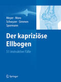 Meyer / Moro / Schwyzer |  Der kapriziöse Ellbogen | eBook | Sack Fachmedien