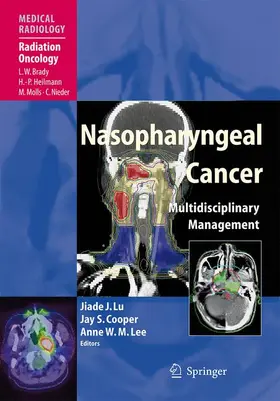 Lu / Cooper / Lee |  Nasopharyngeal Cancer | Buch |  Sack Fachmedien
