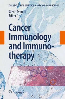 Dranoff | Cancer Immunology and Immunotherapy | Buch | 978-3-642-26788-8 | sack.de