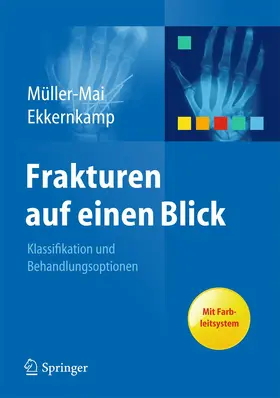 Ekkernkamp / Müller-Mai |  Frakturen auf einen Blick | Buch |  Sack Fachmedien