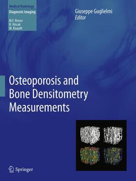 Guglielmi |  Osteoporosis and Bone Densitometry Measurements | Buch |  Sack Fachmedien