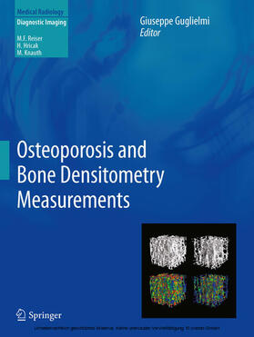 Guglielmi | Osteoporosis and Bone Densitometry Measurements | E-Book | sack.de