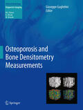 Guglielmi |  Osteoporosis and Bone Densitometry Measurements | eBook | Sack Fachmedien