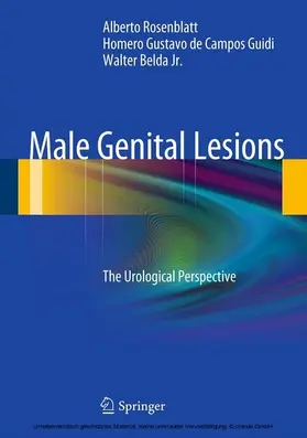 Rosenblatt / de Campos Guidi / Belda Jr. |  Male Genital Lesions | eBook | Sack Fachmedien
