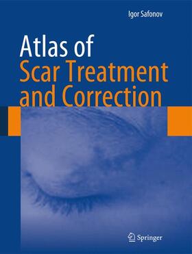 Safonov | Atlas of Scar Treatment and Correction | Buch | 978-3-642-29195-1 | sack.de