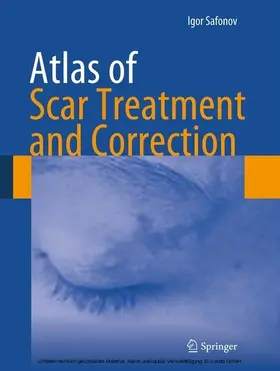 Safonov | Atlas of Scar Treatment and Correction | E-Book | sack.de