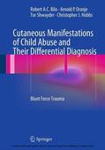 Bilo / Oranje / Shwayder |  Cutaneous Manifestations of Child Abuse and Their Differential Diagnosis | eBook | Sack Fachmedien