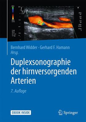 Widder / Hamann |  Duplexsonographie der hirnversorgenden Arterien | Buch |  Sack Fachmedien