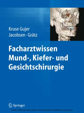 Kruse Gujer / Jacobsen / Grätz | Facharztwissen Mund-, Kiefer- und Gesichtschirurgie | E-Book | www.sack.de