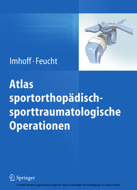 Imhoff / Feucht | Atlas sportorthopädisch-sporttraumatologische Operationen | E-Book | sack.de