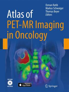 Ratib / Schwaiger / Beyer | Atlas of PET-MR Imaging in Oncology | Buch | 978-3-642-31291-5 | sack.de