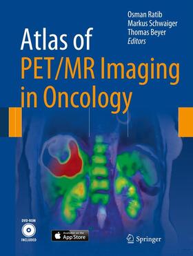 Ratib / Schwaiger / Beyer | Atlas of PET/MR Imaging in Oncology | E-Book | sack.de