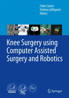 Catani / Zaffagnini | Knee Surgery using Computer Assisted Surgery and Robotics | Buch | 978-3-642-31429-2 | www.sack.de