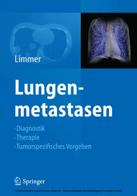 Limmer | Lungenmetastasen | E-Book | www.sack.de