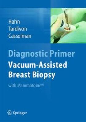 Hahn / Tardivon |  Vacuum-Assisted Breast Biopsy with Mammotome(R) | Buch |  Sack Fachmedien