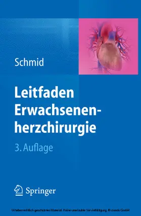 Schmid |  Leitfaden Erwachsenenherzchirurgie | eBook | Sack Fachmedien
