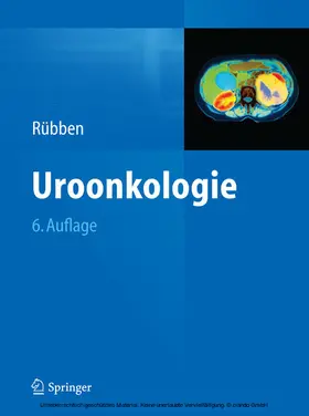 Rübben |  Uroonkologie | eBook | Sack Fachmedien