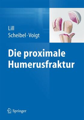 Lill / Scheibel / Voigt | Die proximale Humerusfraktur | Buch | 978-3-642-35256-0 | sack.de
