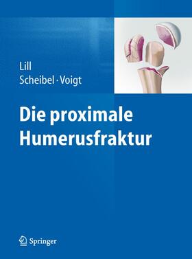 Lill / Scheibel / Voigt | Die proximale Humerusfraktur | E-Book | sack.de