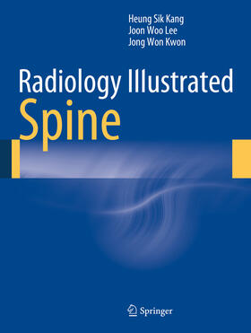 Kang / Lee / Kwon | Radiology Illustrated: Spine | E-Book | sack.de
