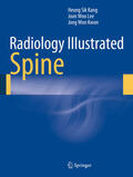 Kang / Lee / Kwon |  Radiology Illustrated: Spine | eBook | Sack Fachmedien