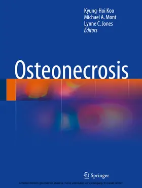 Koo / Mont / Jones |  Osteonecrosis | eBook | Sack Fachmedien